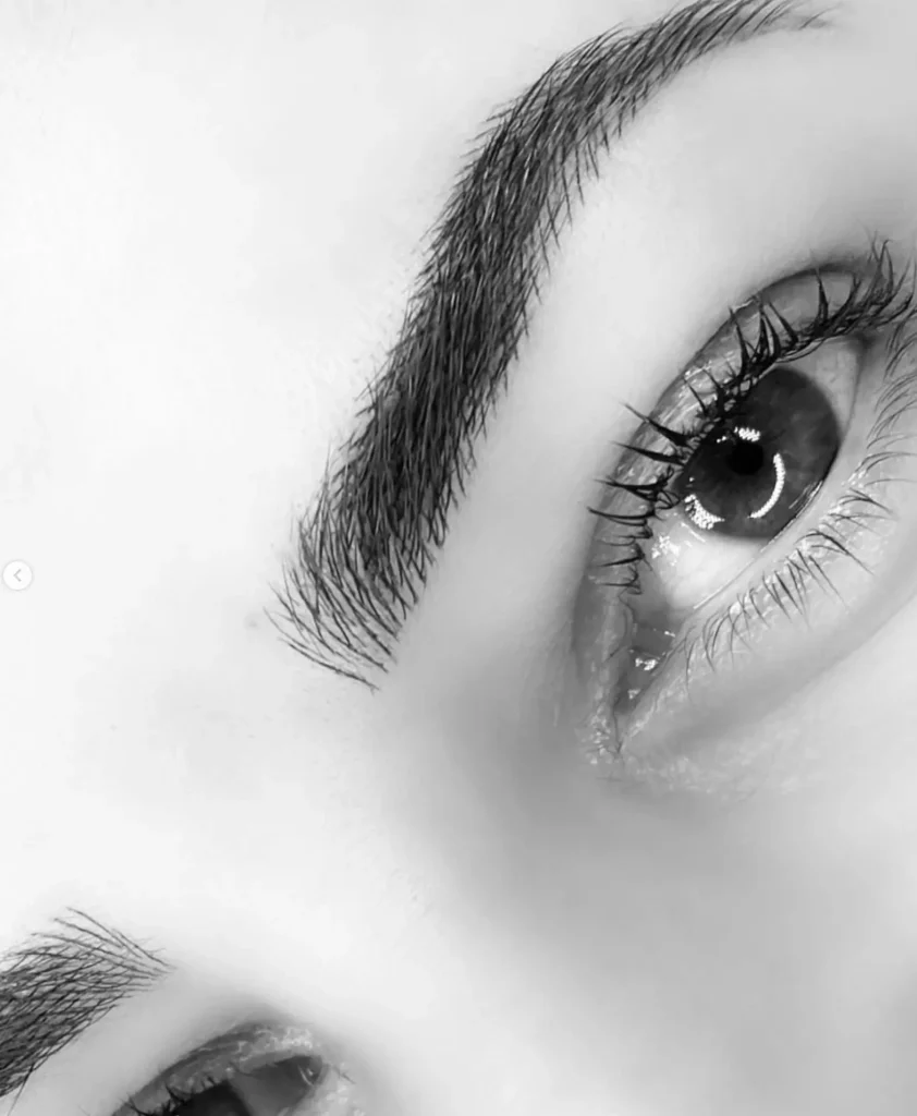 eyebrow tattoo removal Melbourne