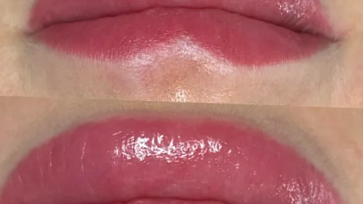 lip tattoo pain scale