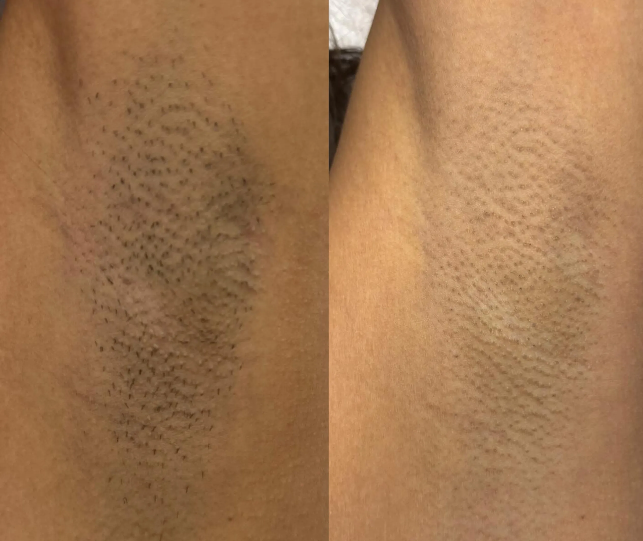 cosmetic laser therapist jobs Australia